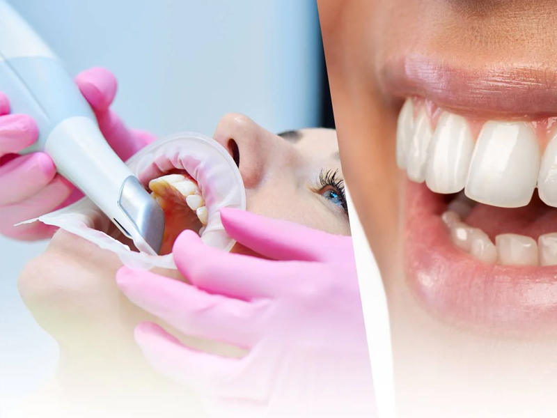 Gülüş Tasarımı Nedir? Kimlere Yapılır?